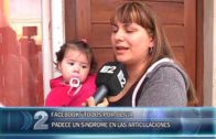 19 -09 -2019 FACEBOOK TODOS POR OLIVIA. PADECE UN SÍNDROME EN LAS ARTICULACIONES